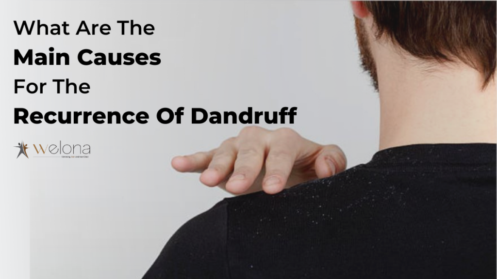 What Are The Main Causes For The Recurrence Of Dandruff