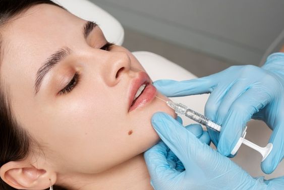 Are Fillers Safe?