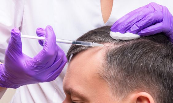 How does PRP for Hair Growth Work?