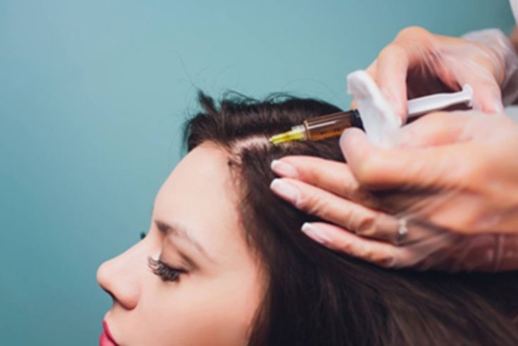How does PRP for Hair Growth Work?