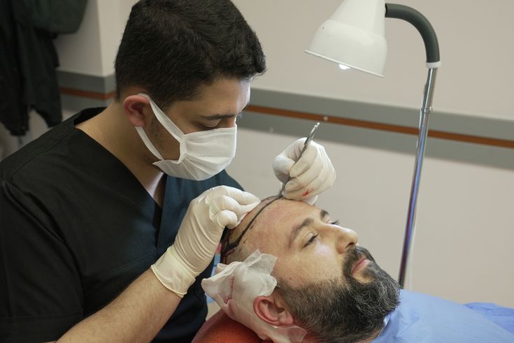 How successful is FUE hair transplant?